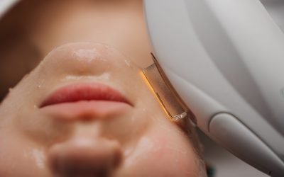 Ten Benefits of Intense Pulse Light (IPL)