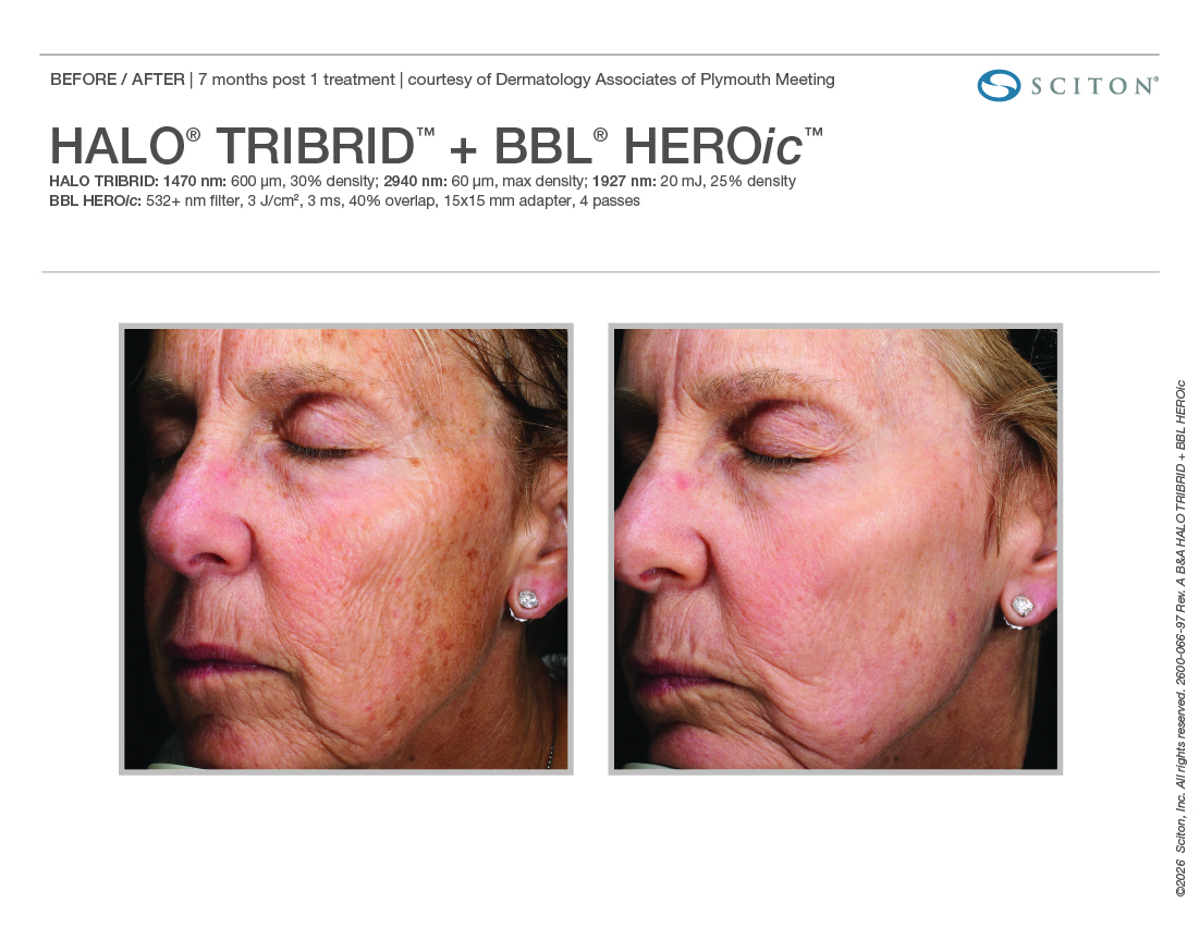 HALO TRIBRID+BBL HEROic_(binder)